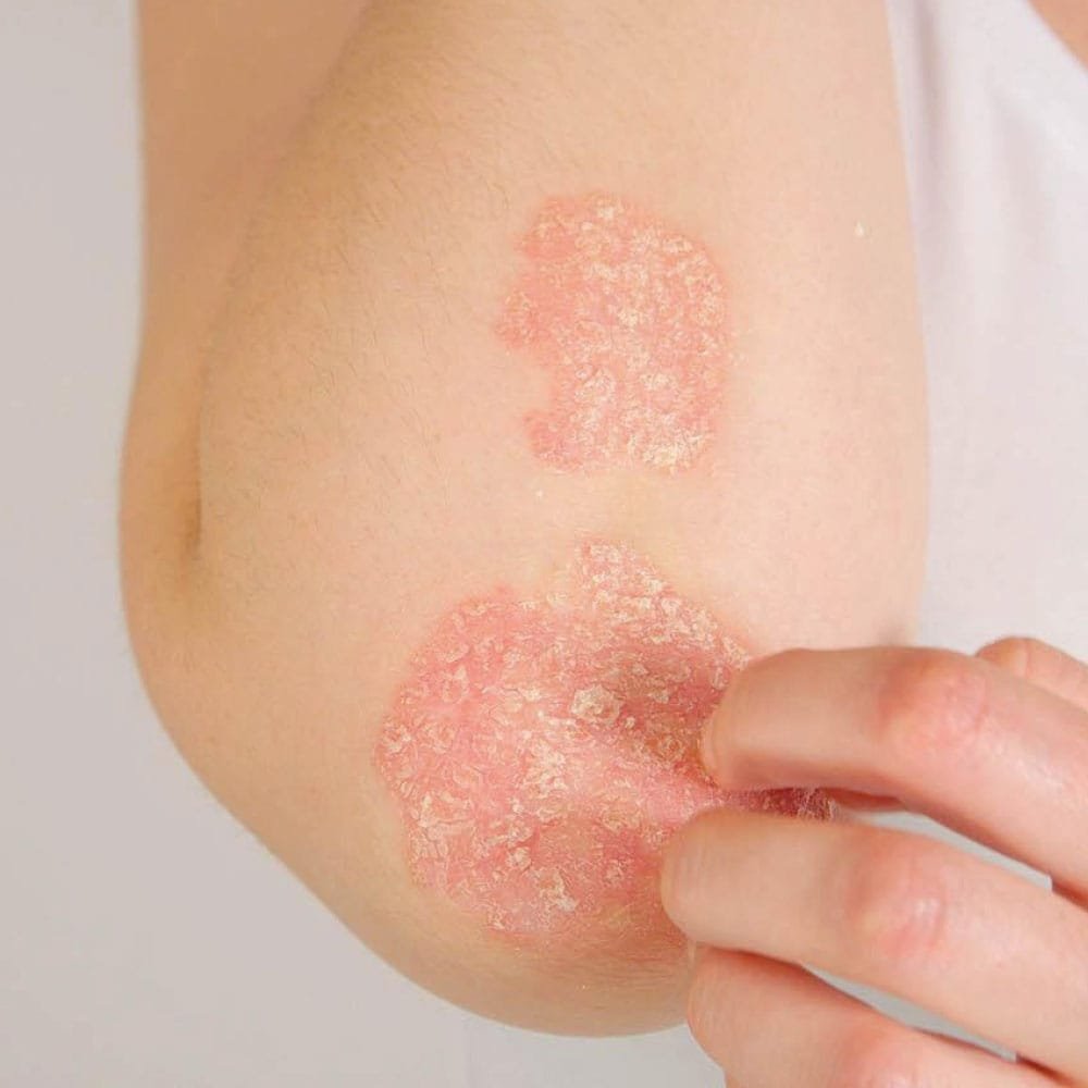 Alphanova Baume Riche Réparateur Intensif - ALPHANOVA Thermal CARE