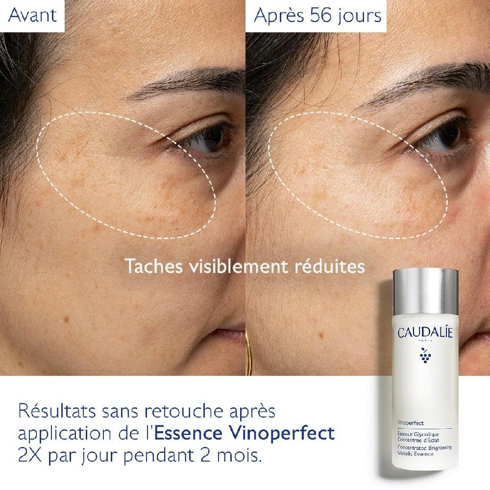 Caudalie Essence Glycolique Concentrée D'Éclat Vinoperfect