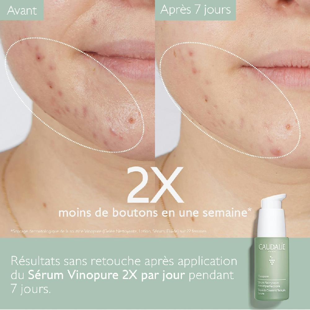 Caudalie Sérum Acide Salicylique Anti-Imperfections - Vinopure