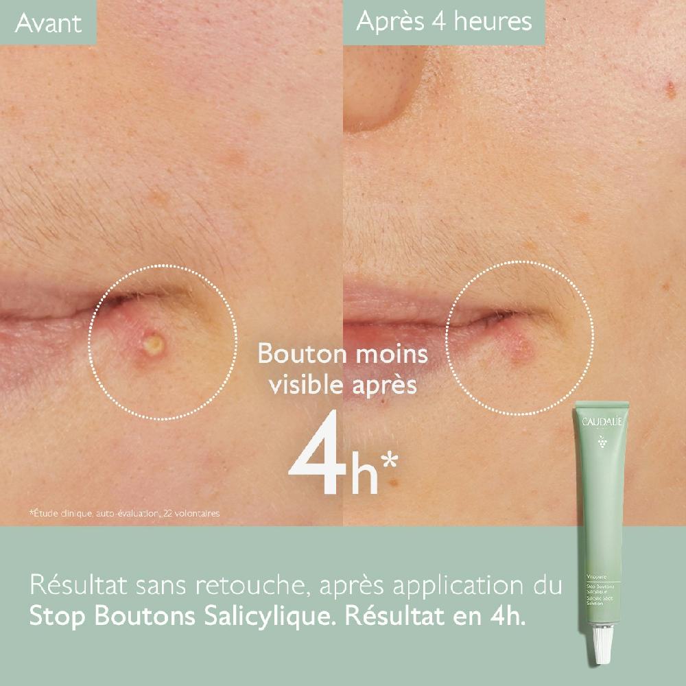 Caudalie Stop Boutons à L'Acide Salicylique - Vinopure