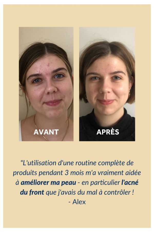 Gallinée Routine Anti Imperfections