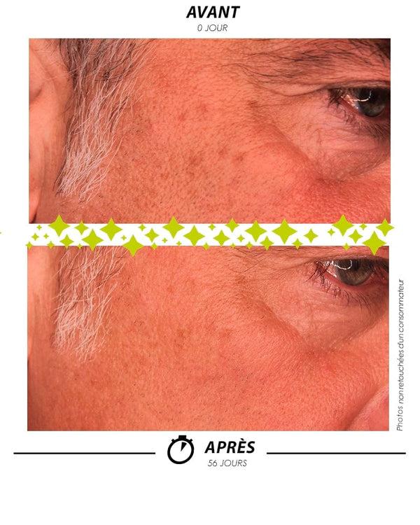 Garancia [ ÉCLAIR De LUNE L'Absolu ] - Sérum Double Phase Anti-Taches (visibles & Invisibles) Correcteur Préventif
