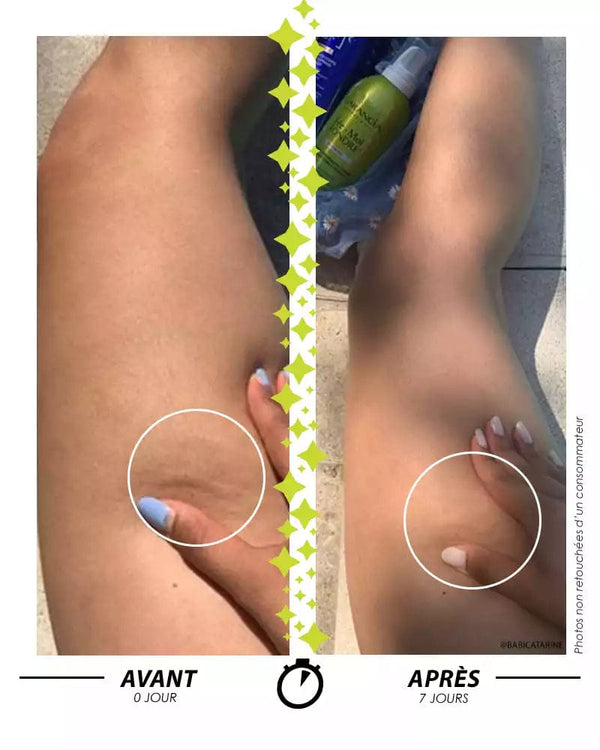 Garancia [ Fée-Moi FONDRE ] BOOSTÉE - Mousse Cryo-crépitante Corps Anti-capiton Express