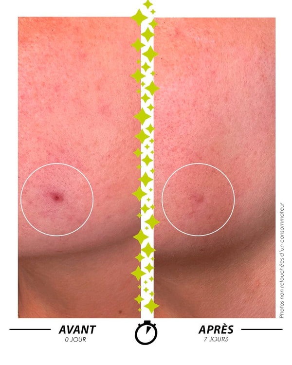 Garancia [ L'ELIXIR DU MARABOUT ] - Sérum Concentré Anti-Imperfections Anti-Âge