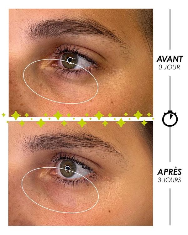 Garancia [ LARMES De FANTÔME ] - Roll-On Multi-Actions Paupières Et Yeux