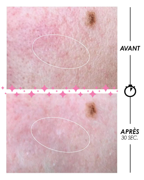 PSCHITT MAGIQUE Nouvelle Peau VISAGE