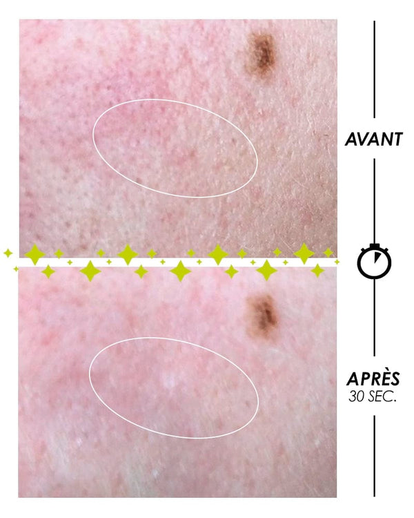 Garancia [ PSCHITT MAGIQUE Nouvelle Peau ] VISAGE - Micropeeling Sans Grain Ni Acide De Fruit à Action Biologique - Visage