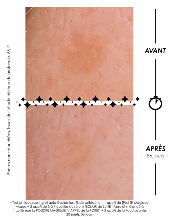 Garancia [ RITUEL CORRECTION ANTI-TACHES ] - Un Rituel Anti-taches Complet