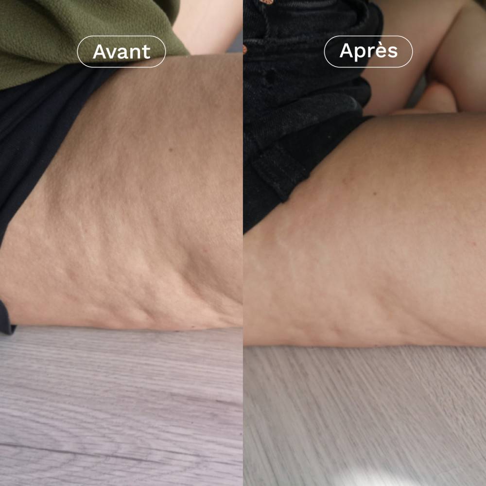 Omum Complément Alimentaire Minceur Anti Cellulite & Fermeté – 1 Mois