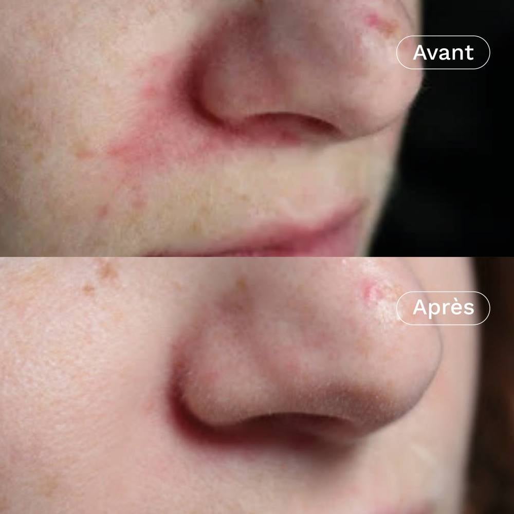 Omum Crème Hydratante Visage Et Rééquilibrante - 40 Ml