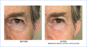 Orlane Absolute Skin Recovery Care Eye Contour