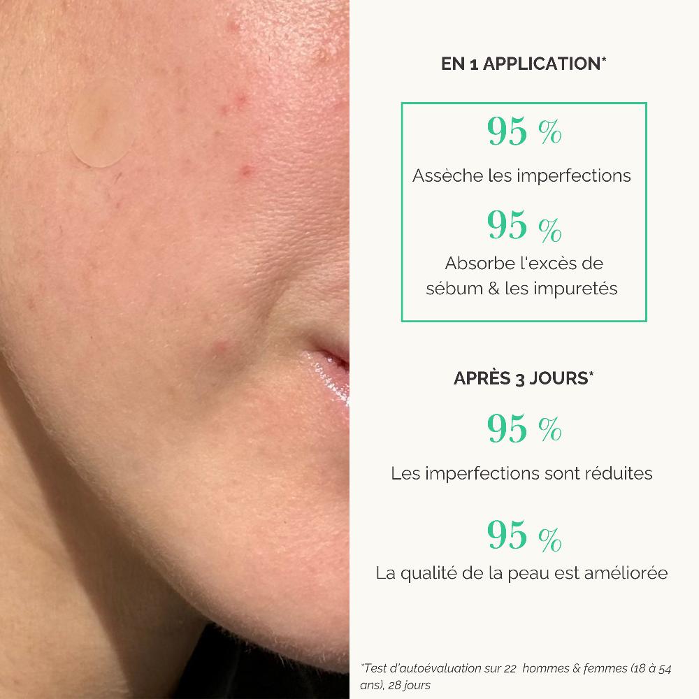 Qiriness Patch Anti-imperfections Aloe Vera - Flash Patch®