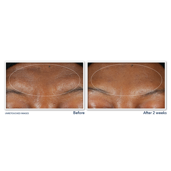 Roc RETINOL CORREXION® Deep Wrinkle Serum Cleanser