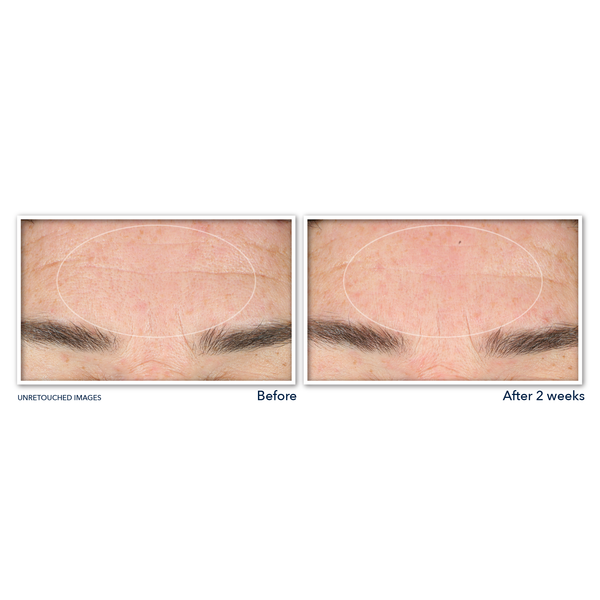 Roc RETINOL CORREXION® Deep Wrinkle Serum Cleanser