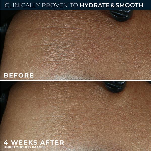 Roc RETINOL CORREXION® Line Smoothing Max Hydration Cream Fragrance Free