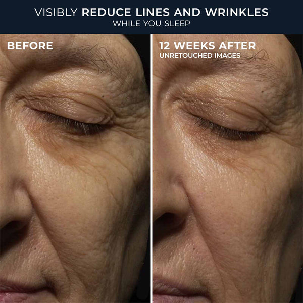Roc Deep Wrinkle PM Jumbo Deluxe Duo