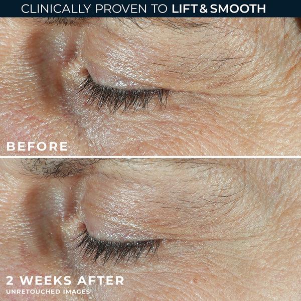 Roc DERM CORREXION® Dual Eye Cream