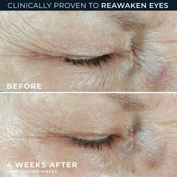 Roc Hydration+ Eye Cream