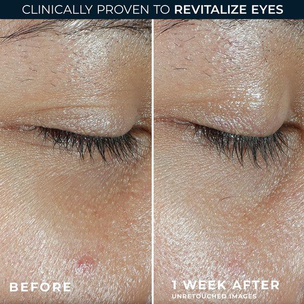 roc MULTI CORREXION® Revive + Glow Eye Balm