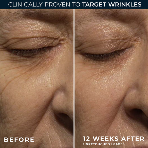 Roc RETINOL CORREXION® Deep Wrinkle Night Cream