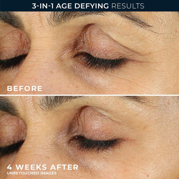 Roc RETINOL CORREXION® Line Smoothing Eye Cream