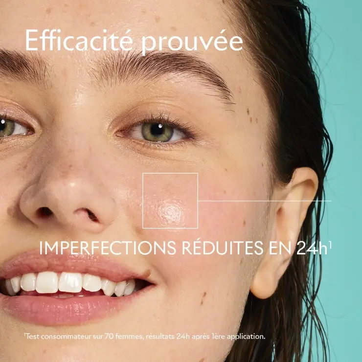 Sanoflore SOS Anti-boutons Ciblé Soin Ciblé SOS Réduit Les Boutons Dès 24h