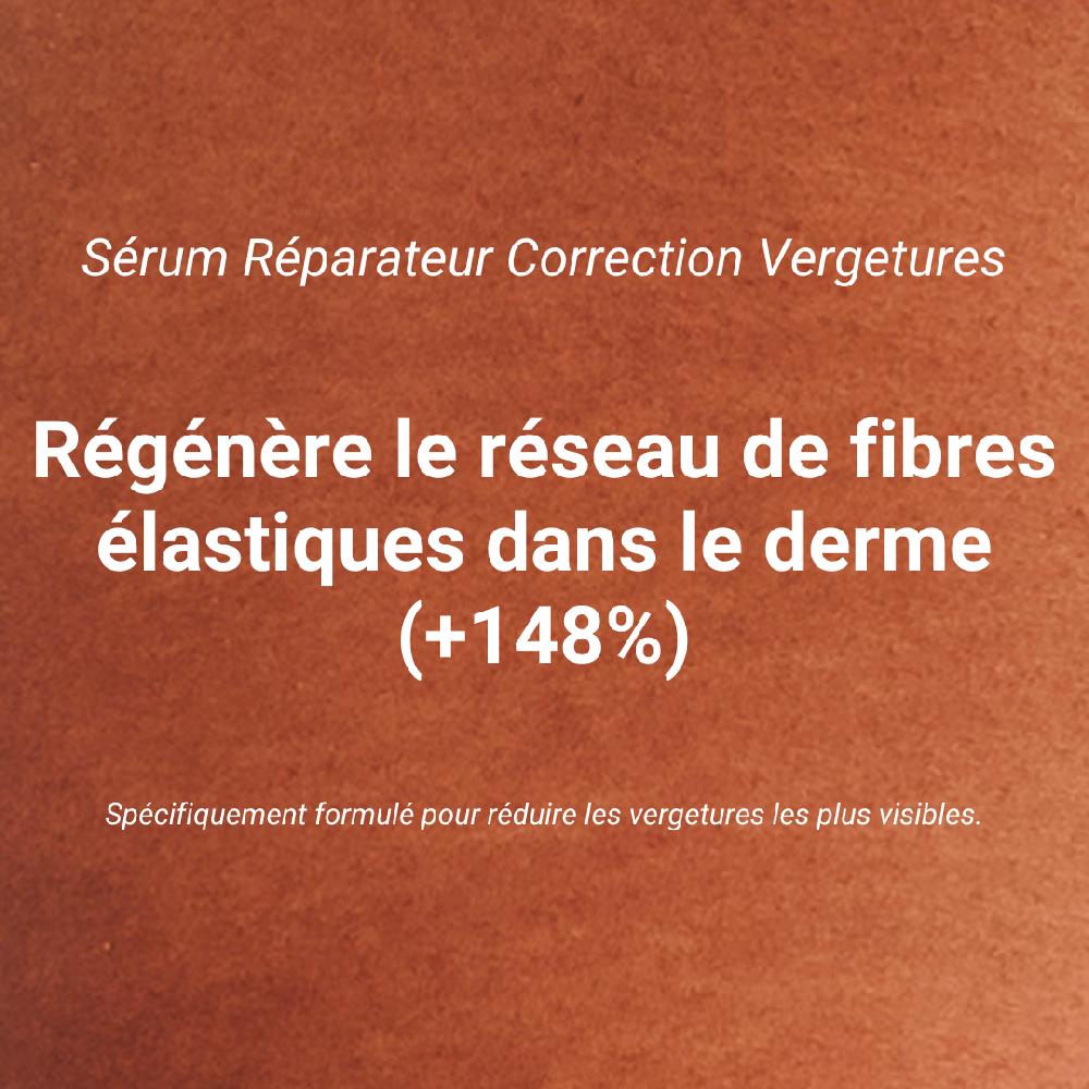 somatoline Cosmetic Correction Vergetures Sérum Réparateur