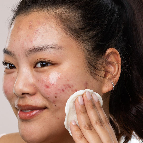 Svr SEBIACLEAR | Peaux à Tendance Acnéique Eau Micellaire