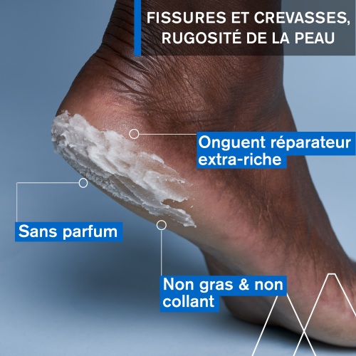 Uriage BARIÉDERM-CICA Onguent Fissures Crevasses