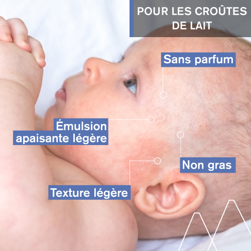 Uriage BÉBÉ - 1ER SOIN CROÛTES DE LAIT